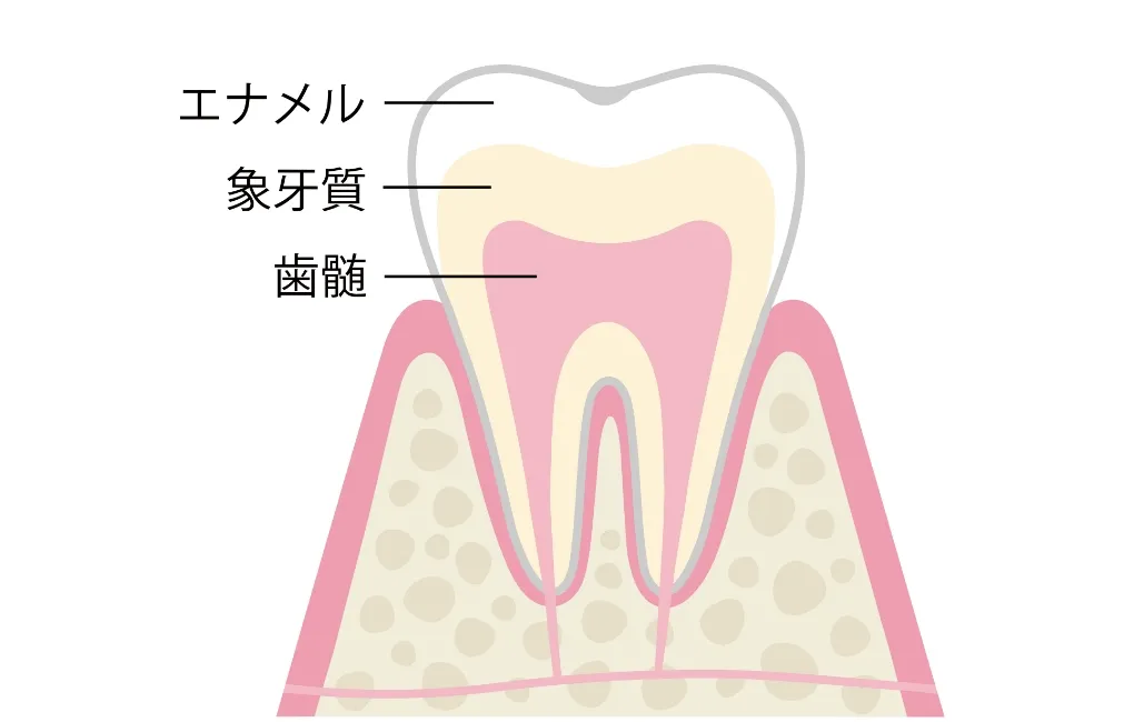 初期のむし歯について(エナメル質のむし歯)
