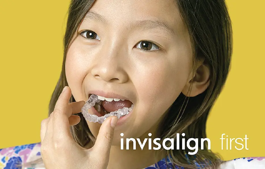 子どものための透明なマウスピース型矯正装置インビザラインファースト