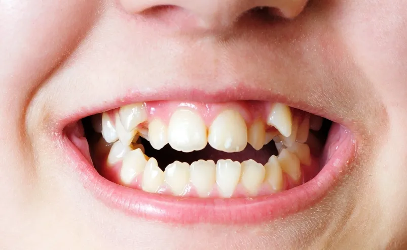 幅広い症例に対応可能