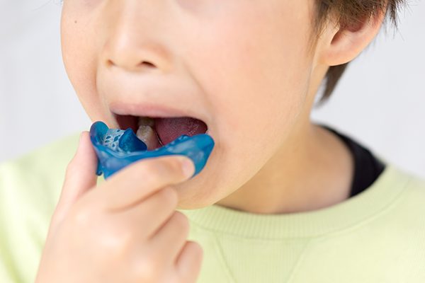 マウスピース矯正も行なっています